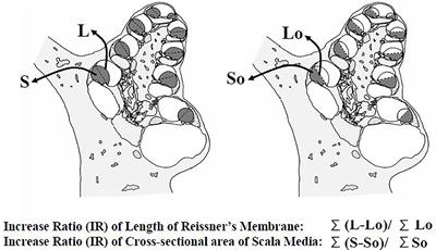 Effects of Glucocorticoids on the Inner Ear
